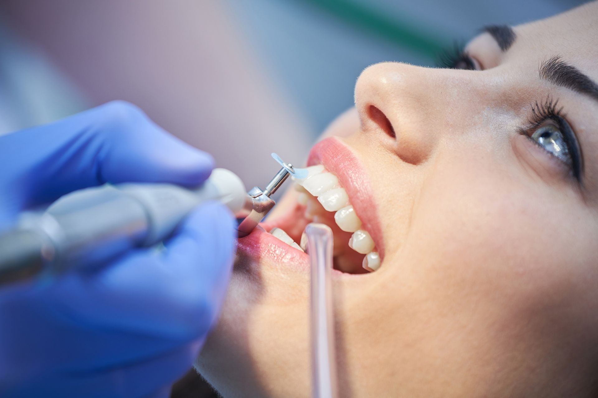 close-up medical dentist procedure of teeth polishing. Dentist making professional teeth cleaning female young female patient at the dental office. Close-up plan